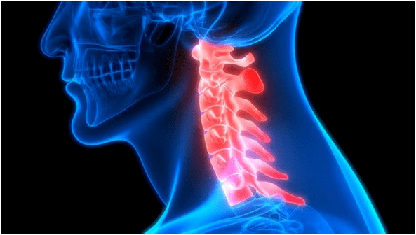 गर्दन का दर्द पीठ दर्द की ओर ले जाता है