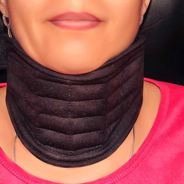 ग्रीवा रीढ़ की ओस्टियोचोन्ड्रोसिस के लिए चिकित्सा नाकाबंदी के बाद गर्दन की पट्टी